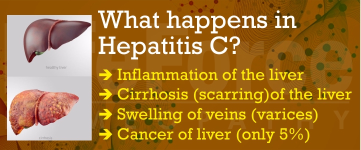 Causes of Hepatitis C